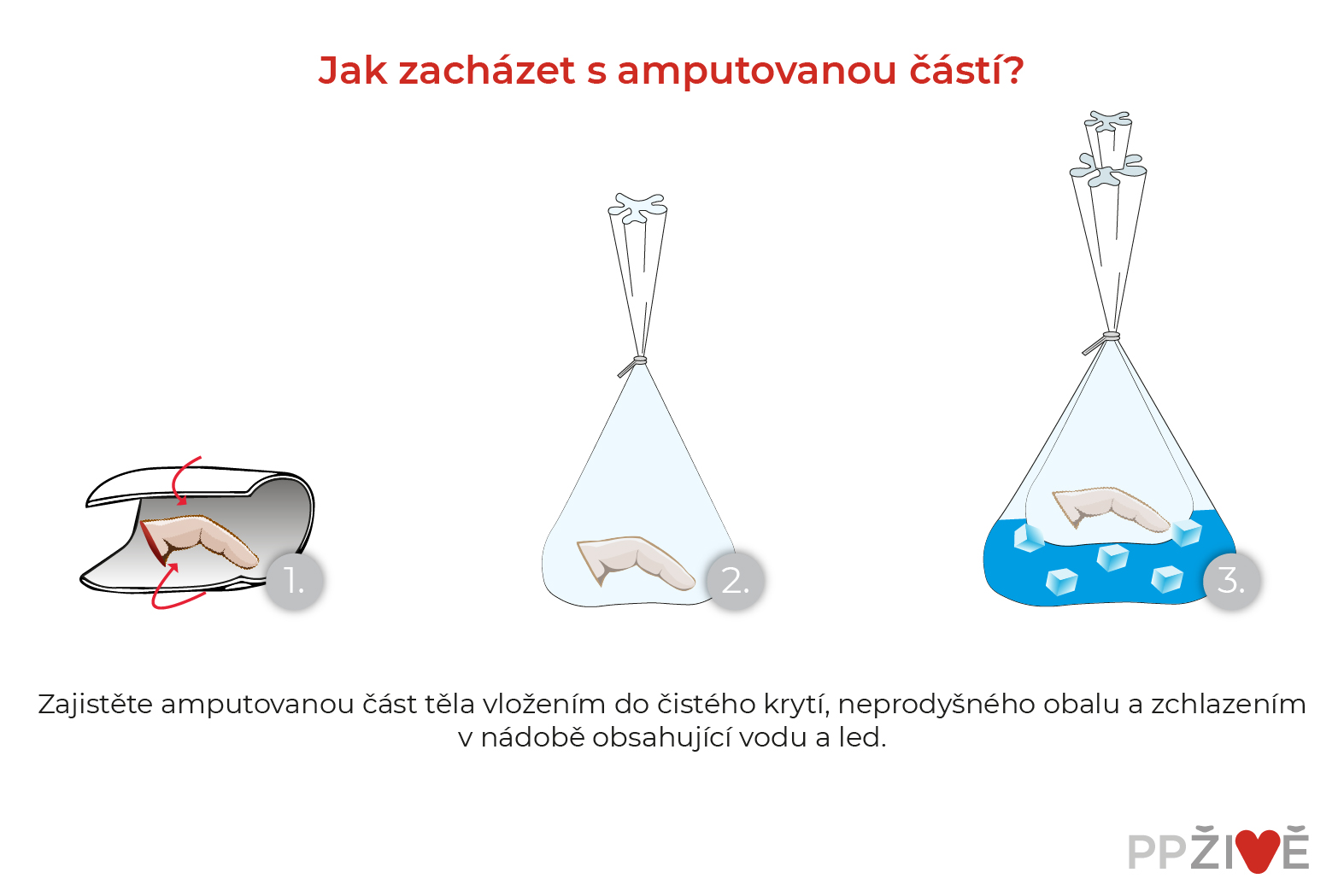 Jak zajistit Amputát?